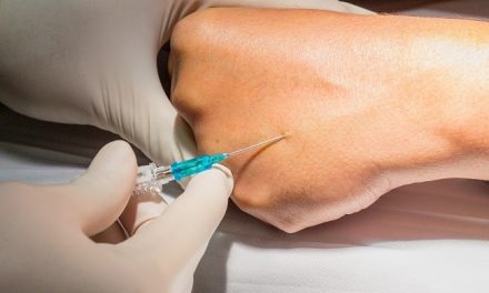 Efek Samping Infus Dan Cara Mengatasinya