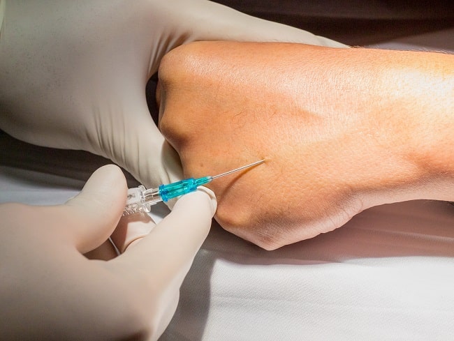 Efek Samping Infus Dan Cara Mengatasinya